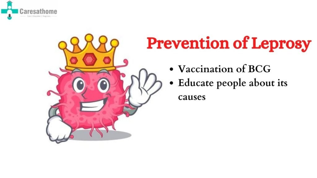 How to Prevent Leprosy Through Awareness and Early Care