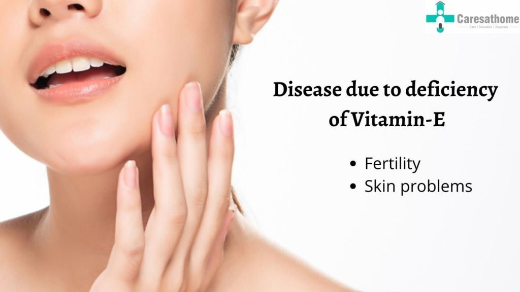 Health Issues Linked to Vitamin E Deficiency